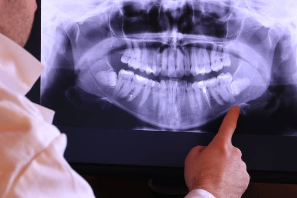 Best Emergency TMJ Treatment in Northbrook, OH